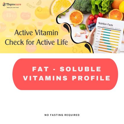 Fat - Soluble Vitamins Profile (6 tests)